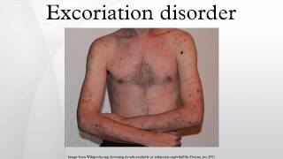 Excoriation disorder [upl. by Tamah]