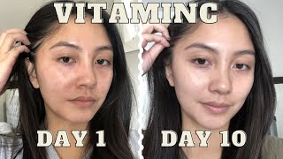 adding VITAMIN C serum to my skincare routine for 10 days  Vichy LiftActiv before amp after [upl. by Lunneta]