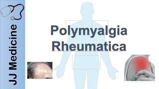 EXTRAPYRAMIDAL SYMPTOMS EPSs Mental Health Nursing [upl. by Jorgenson]