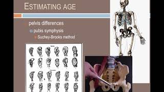 Forensic Anthropology Identifying individuals [upl. by Ehcram]