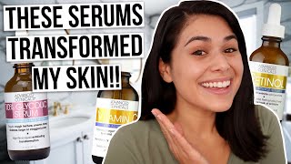 3 BEST Serums for Acne and Hyperpigmentation UNDER 16 [upl. by Releyks]