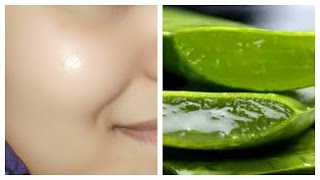 How to get clear glowing spotless skin by using aloe Vera gel [upl. by Sayce]