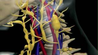 How Lymphoma Develops [upl. by Walburga850]