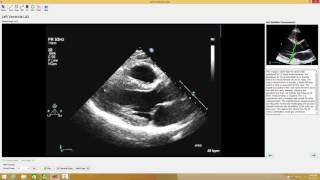 2 Echo Test and Teach Measurement Case [upl. by Clower229]