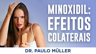 Minoxidil Efeitos Colaterais  Dr Paulo Müller Dermatologista [upl. by Ailbert823]