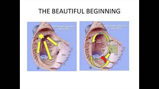 Typical Atrial Flutter Dr Hernandez [upl. by Selwin]