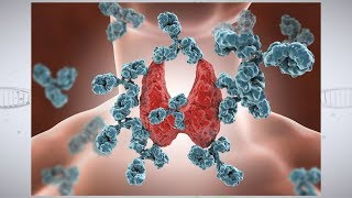 Thyroid Cancer Symptoms amp Early Warning Signs [upl. by Oranneg159]