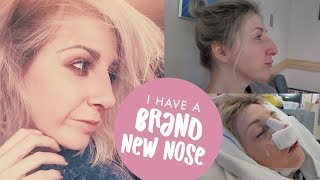 NOSE JOB VLOG  From Surgery to Recovery Rhinoplasty  Septorhinoplasty Journey [upl. by Psyche519]