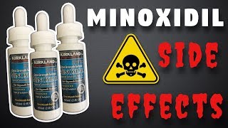 Minoxidil Side Effects  What To Expect [upl. by Nawaj740]