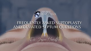 Septoplasty Frequently Asked Questions by Dr Jason S Hamilton [upl. by Norina]