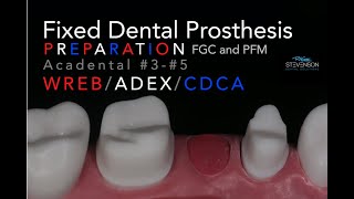 Fixed Dental Prosthesis Preparation  35 Acadental  WREBADEXCDCA [upl. by Artcele191]