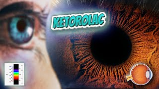 Ketorolac 10 mg Toradol What is Ketorolac Used For Dosage Side Effects and Precautions [upl. by Koorb]