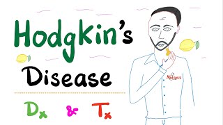 Hodgkin’s Disease  Hodgkin Lymphoma  Diagnosis amp Treatment  Hematology amp Oncology [upl. by Nauqyaj]