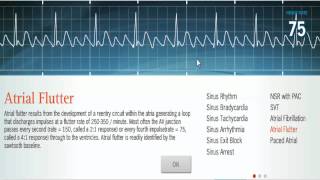 Atrial Arrhythmias NSR Atrial Flutter Atrial Fibrillation [upl. by Keegan]