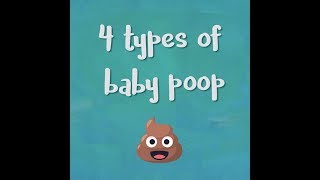 Baby poop guide 4 types of baby poop [upl. by Cecilla441]