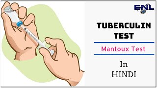 Mantoux Test  Tuberculin Skin Test in Hindi  Easy Explanation [upl. by Niaz]