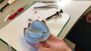 Lab Fabrication of Temporary Implant Crown Nobel Snap In Abutment [upl. by Jary538]