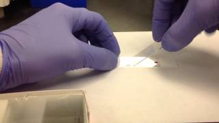 Hematology Making a Peripheral Blood Smear [upl. by Josepha81]