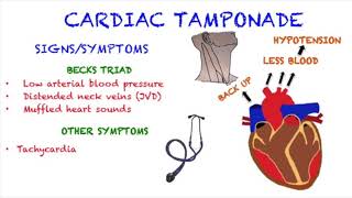 Cardiac Tamponade [upl. by Aiyotal]