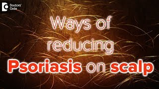 What helps psoriasis on scalp  Dr Rasya Dixit [upl. by Bogusz]