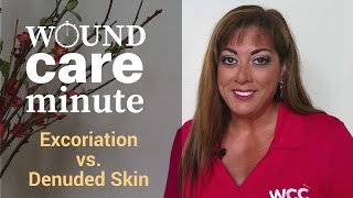 Whats the Difference Between Excoriation and Denuded Skin [upl. by Angelita]