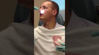 Septoplasty and Turbinate Reduction Splint Removal [upl. by Yrruc]