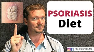 Effects of Food and Diet on Psoriasis [upl. by Zed771]