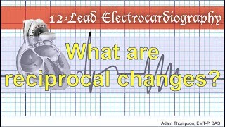 What are reciprocal changes [upl. by Jestude336]