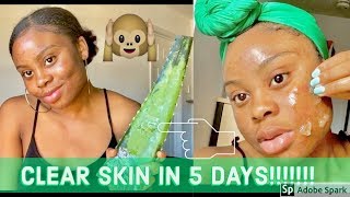 I USED FRESH ALOE VERA GEL ON MY SKIN FOR 5 DAYS amp THIS HAPPENED [upl. by Parthena]