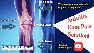 Total Knee Replacement Day 3 Understand whats really going on [upl. by Janaya]