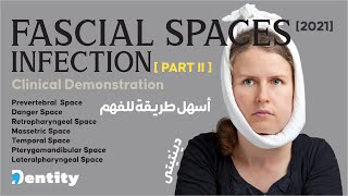 شرح مبسط  Fascial Spaces Infection  PART 22 [upl. by Mary]