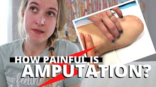 How BAD Does AMPUTATION Hurt [upl. by Nevart]