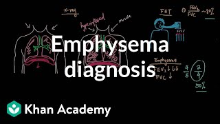 Emphysema diagnosis  Respiratory system diseases  NCLEXRN  Khan Academy [upl. by Kurth]