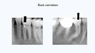 Endodontics from A to Z series 1Basics [upl. by Medrek92]