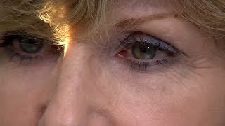 After your Cataract Operation how to administer eye drops [upl. by Margie636]