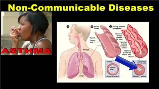 Noncommunicable Diseases [upl. by Yrakcaz287]