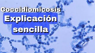 Coccidiomicosis fácil explicación [upl. by Andee]