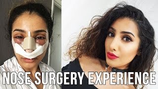 My Nose Surgery Experience VLOG [upl. by Marlow721]